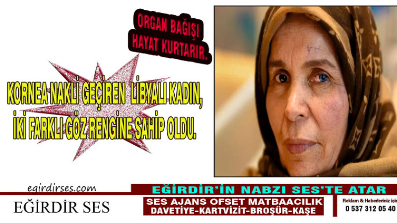 KORNEA NAKLİ GEÇİREN LİBYALI KADIN, İKİ FARKLI GÖZ RENGİNE SAHİP OLDU.